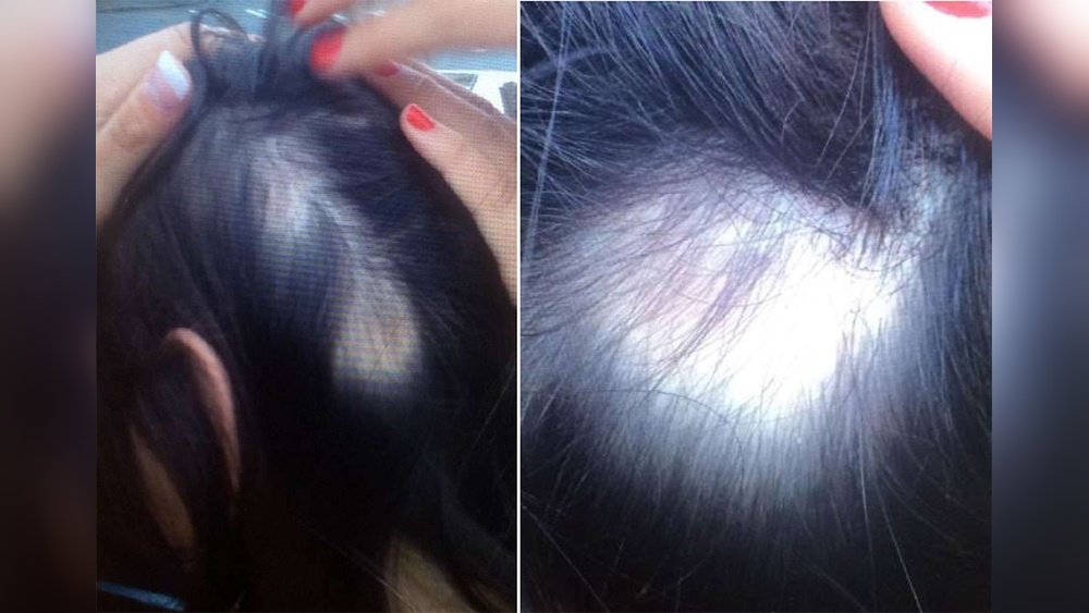 Can Conditioner Cause Hair Loss Can Conditioner Cause Hair Loss