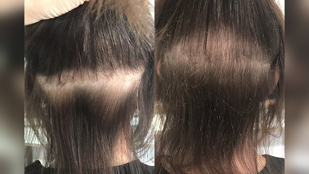 Can Hair Extensions Ruin Your Hair Can Hair Extensions Ruin Your Hair