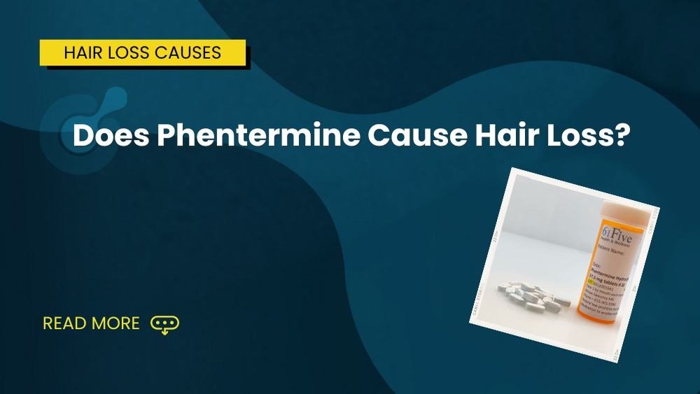 Can Phentermine Cause Hair Loss Can Phentermine Cause Hair Loss