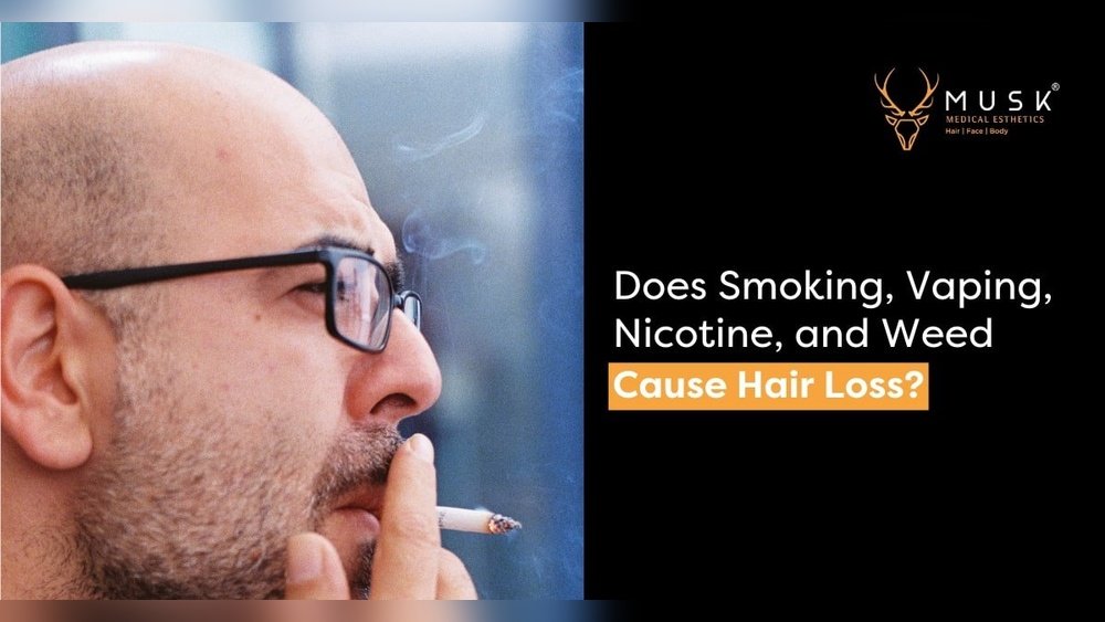 Can Weed Cause Hair Loss Can Weed Cause Hair Loss