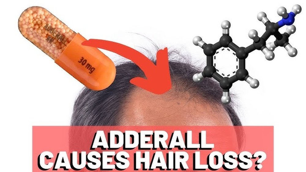Does Adderall Cause Hair Loss Does Adderall Cause Hair Loss