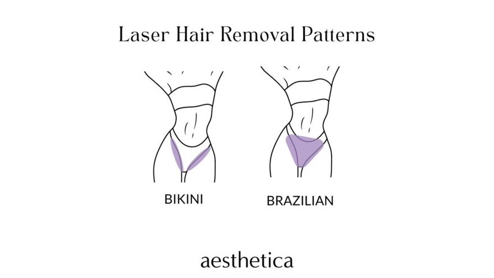 How Much Is a Full Brazilian Laser Hair Removal How Much Is a Full Brazilian Laser Hair Removal