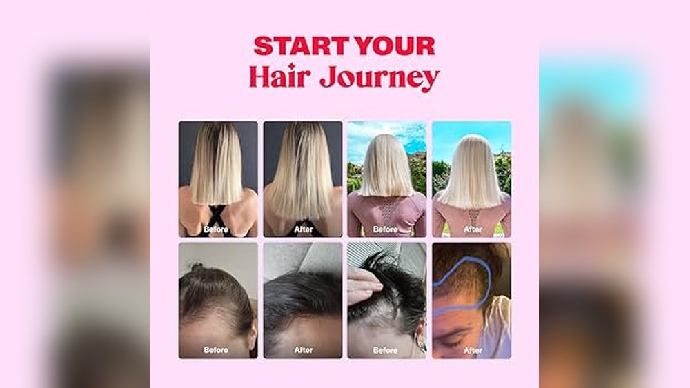 Will Prenatal Vitamins Help With Hair Growth Will Prenatal Vitamins Help With Hair Growth