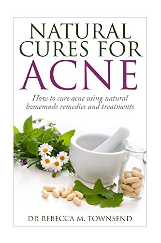 Natural cures for acne: How to cure using home remedies