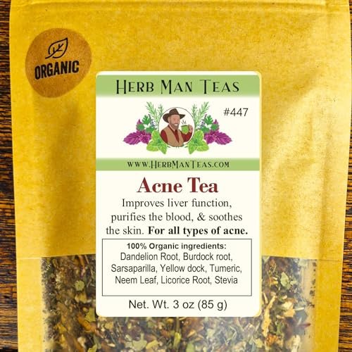 ACNE TEA – Organic Herbal Blend to Support Clear Skin